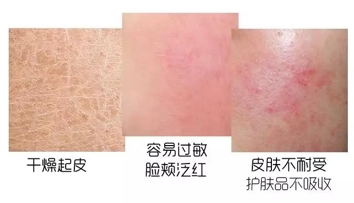 日本curel珂润水乳有什么功效,日本curel珂润水乳测评