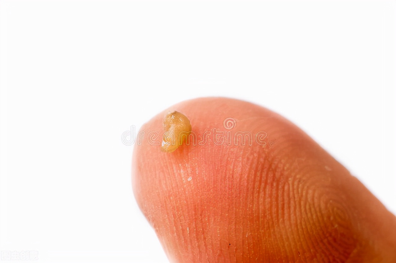 手把手教你有效去黑头的方法,最有效去黑头方法推荐