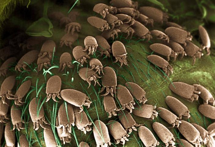 洗澡时搓下来的泥是什么?在显微镜下放大一百倍,看后让人不舒服