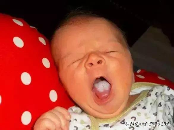 新生宝宝常见的问题--鹅口疮