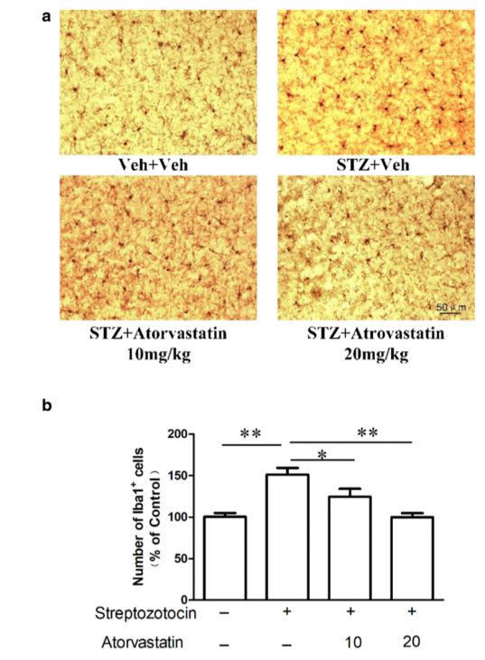 心智化失能介导童年期情感虐待与成年期抑郁症症状的联系