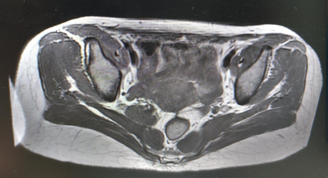 病例分享小结,病例分享及讨论