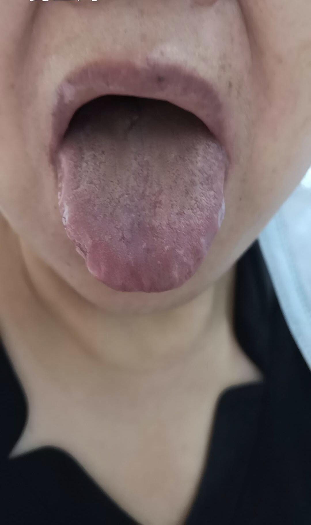 一位30年便秘患者的心里话：吃贾主任的中药，改善的不仅是便秘