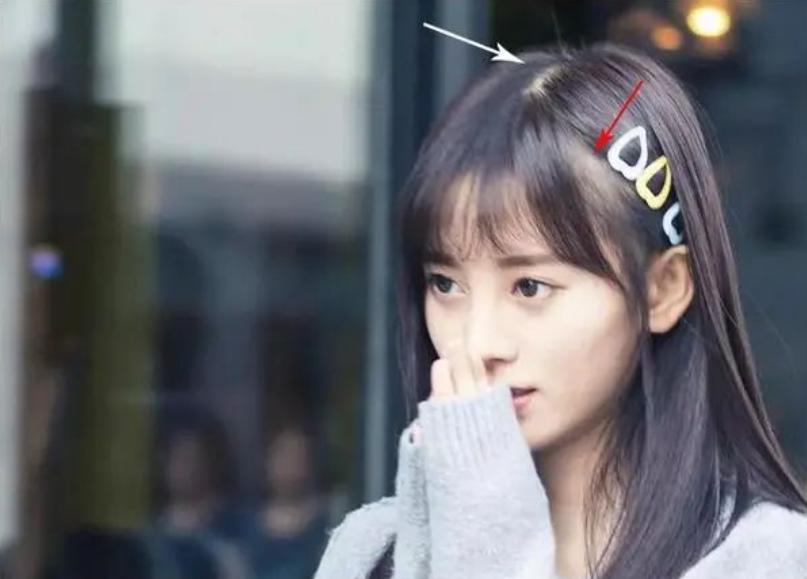 彭昱畅是雄激素脱发吗,彭昱畅脱发视频完整版