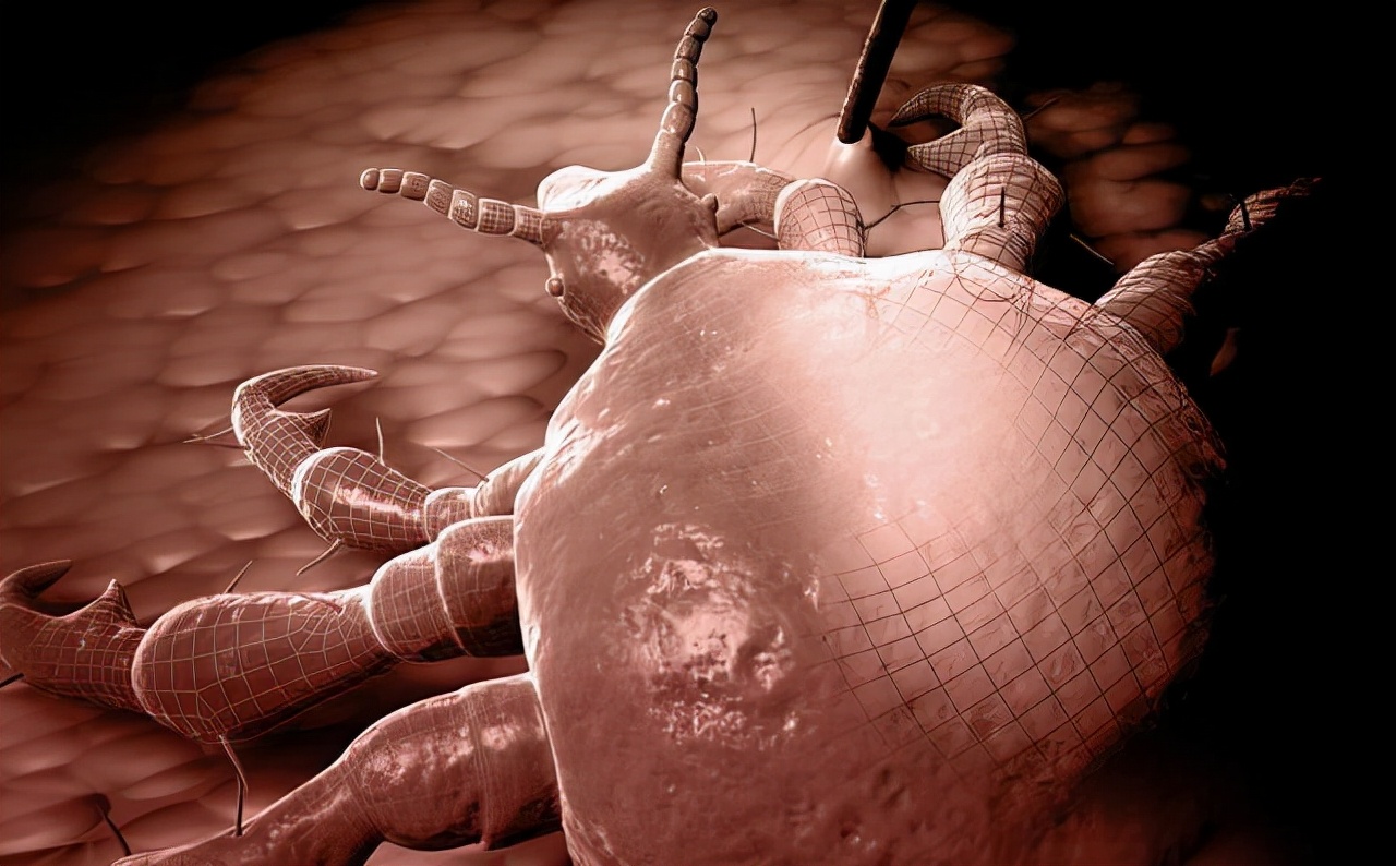 什么情况下会产生阴虱病,什么是阴虱怎么治