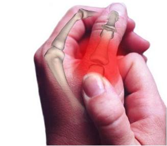 手指关节疼痛的原因和治疗方法,手指关节疼痛是什么原因30岁