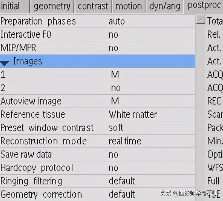 「MRI技术」磁共振伪影分析，了解下SSh_FLAIR序列