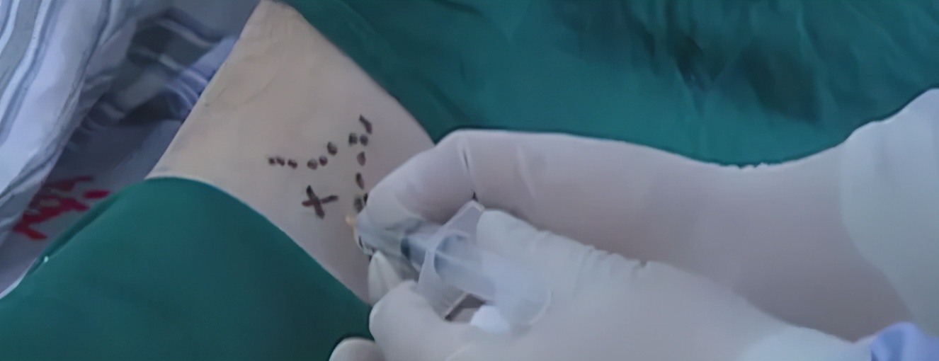 镇痛注射教学视频,疼痛科注射药物及方法