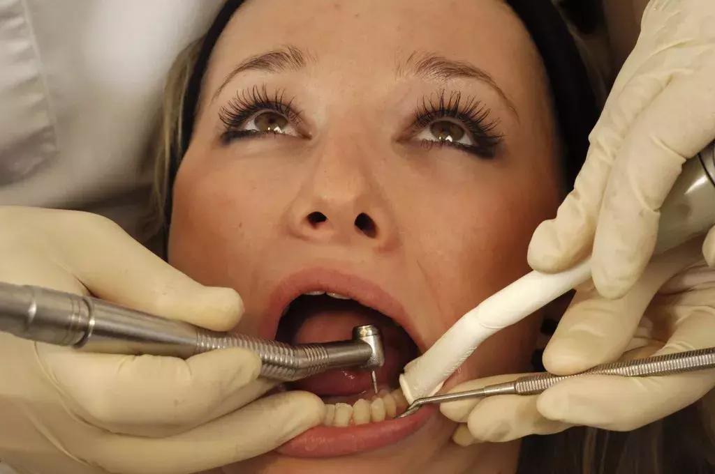 几百块补一个牙是智商税吗,几十块钱的补牙可行吗