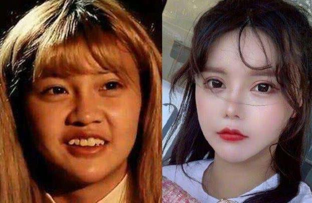 50岁女性整容后续,50岁女人突然整容