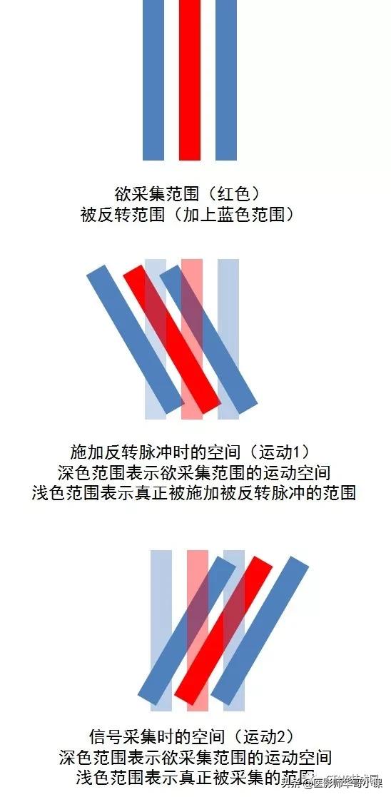 「MRI技术」磁共振伪影分析，了解下SSh_FLAIR序列