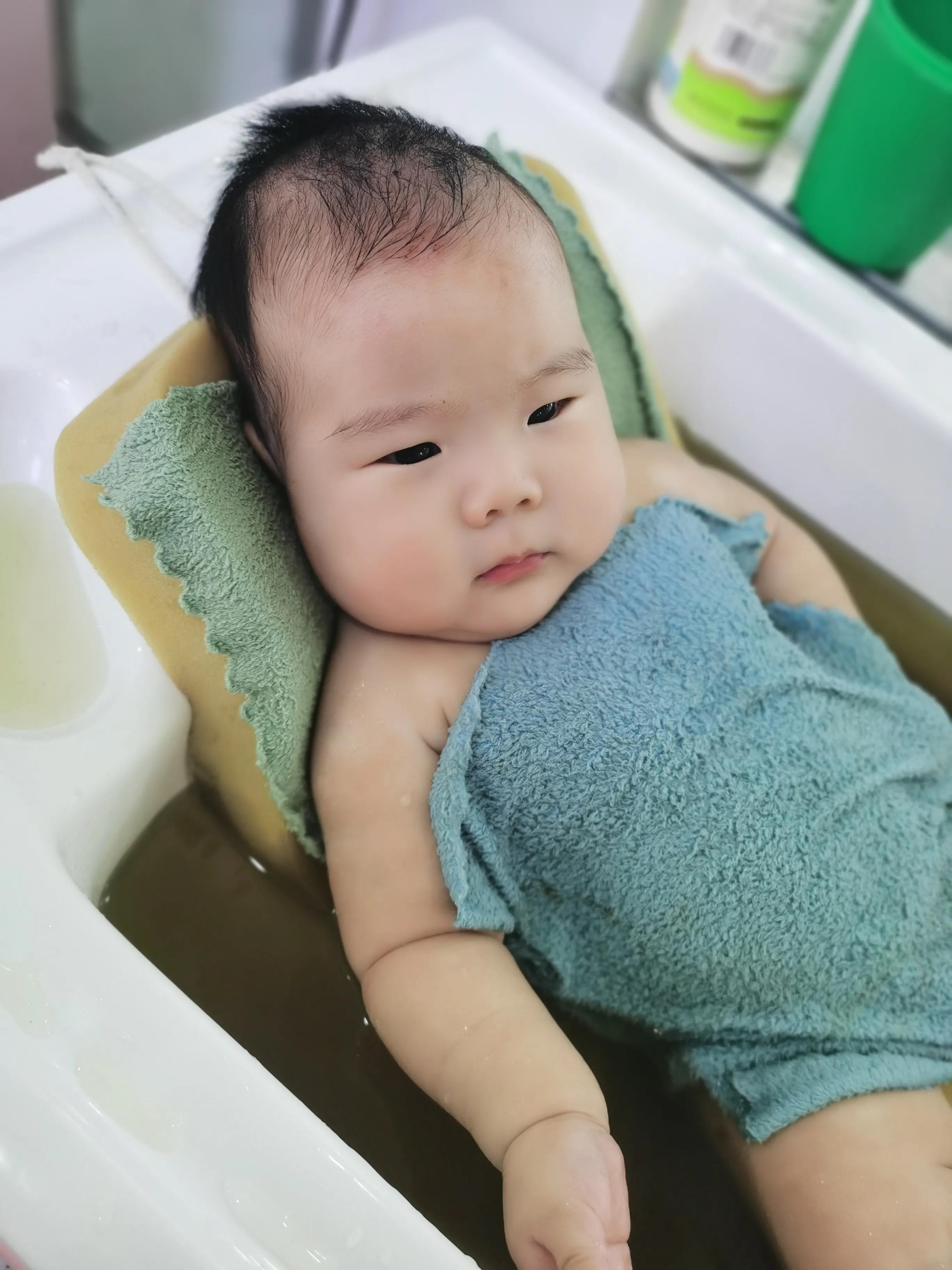 宝宝身体褶皱处发红发干,婴儿褶皱处发红抹什么