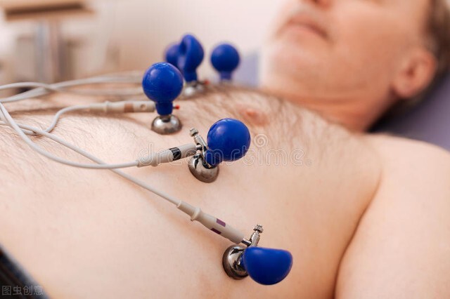 怎么确定自己是否患上了心血管疾病？该如何去监测？