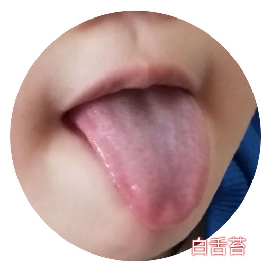 小孩受凉感冒初期中医怎么处理,孩子感冒初期如何快速抑制感冒