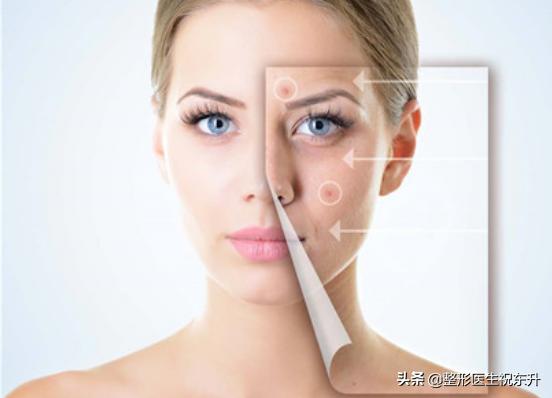 激光为什么能抗衰,做激光有风险吗