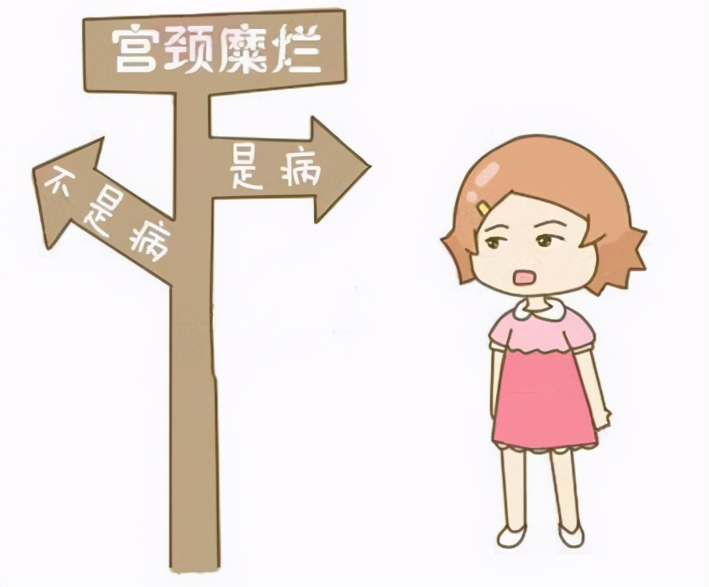 宫颈癌和宫颈糜烂症状一样不,宫颈糜烂与宫颈癌的症状区别