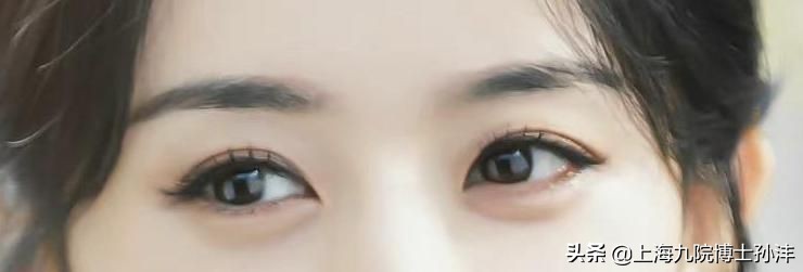 明明是双眼皮却老是不显为什么,为什么割了双眼皮反而不好看了