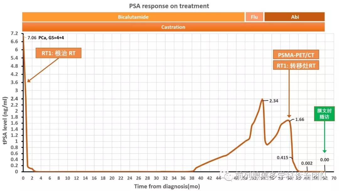 前列腺癌精准诊疗,前列腺癌辅助放疗和挽救放疗
