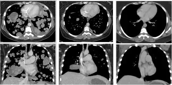 国外最新的抗癌药叫什么名字,美国十大抗癌药物排名