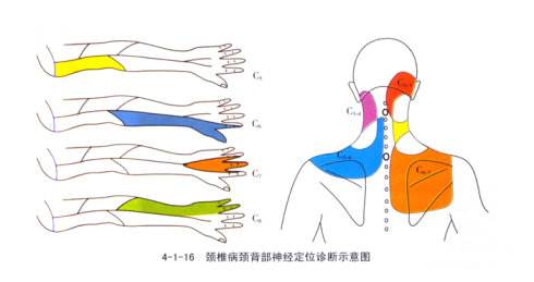 左肩膀痛如何区别肩周炎或颈椎病,肩膀疼不是肩周炎肯定是癌症吗