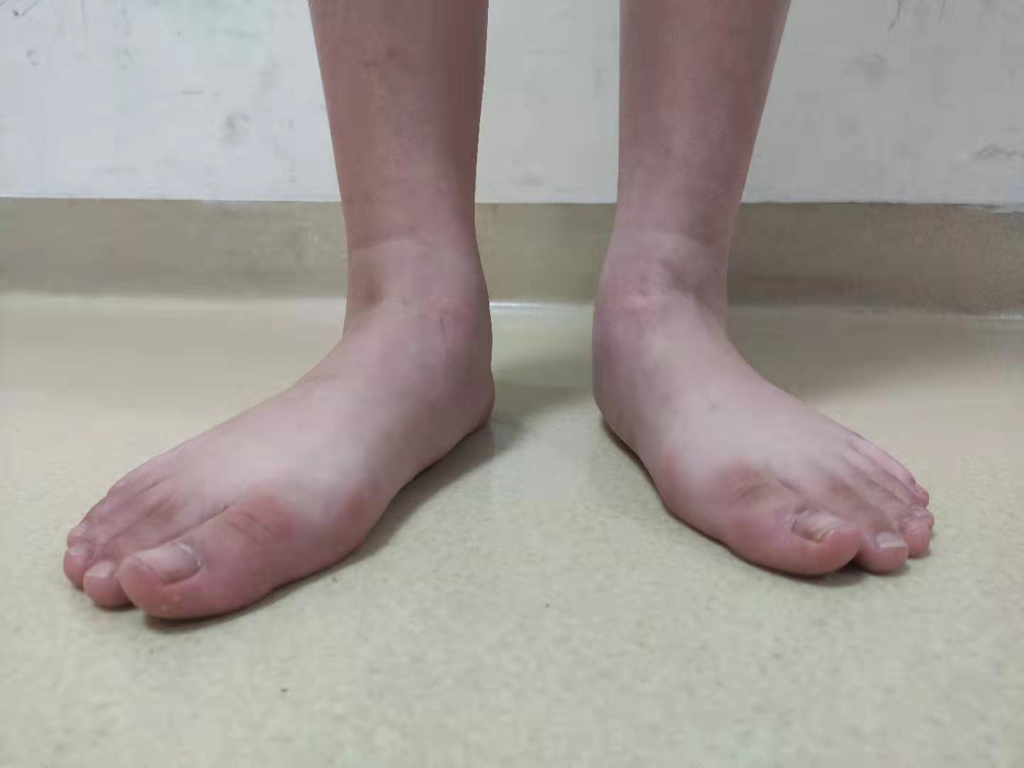 总是感觉小腿肚酸疼是什么原因,经常感觉小腿肚子酸胀中医怎么说