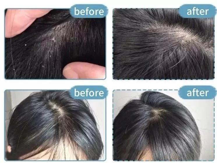 沙宣“退位让贤”,护发届翘楚“阿玛尼”上线,网友:良心洗发水