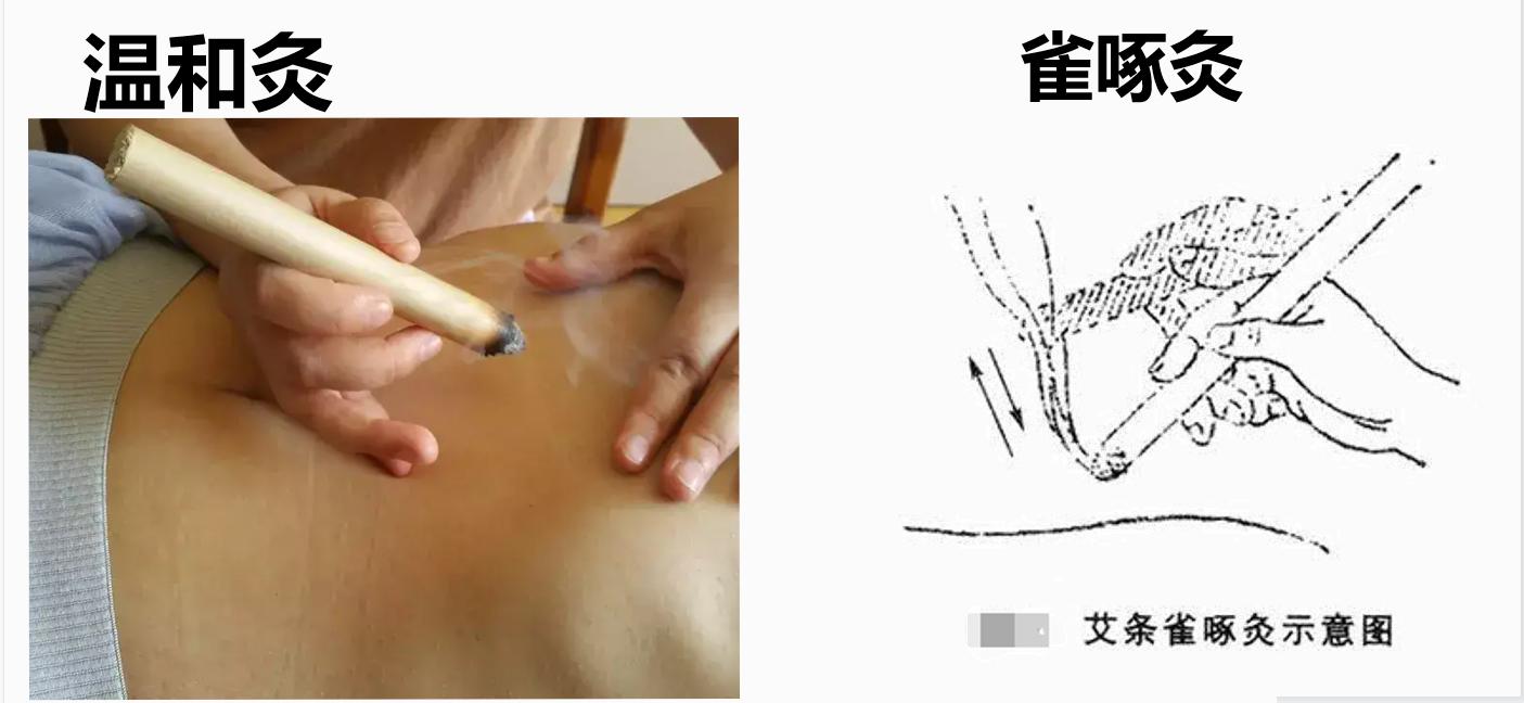 艾灸高手视频教程大全,中医艾灸师怎么样