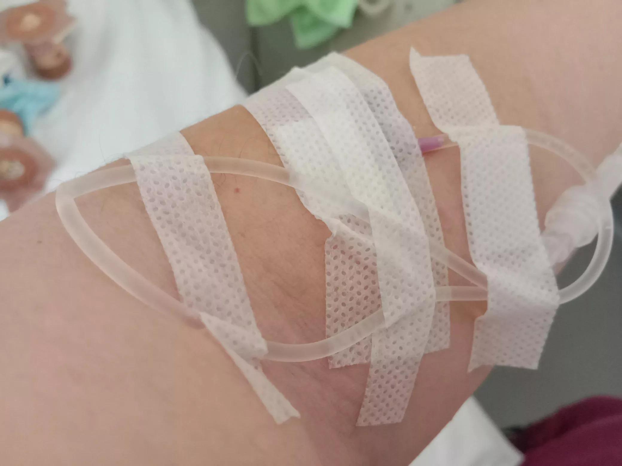 乳腺癌术后14个月复查,乳腺癌术后复查一次多少钱