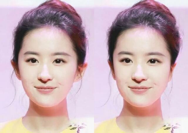 私密整容紧缩手术在中国合法吗,整容医院做私密收紧术要住院吗