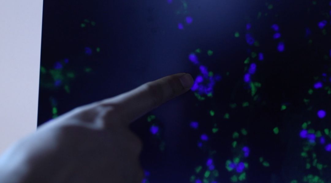 央视重口法医纪录片,网友直呼看不过瘾