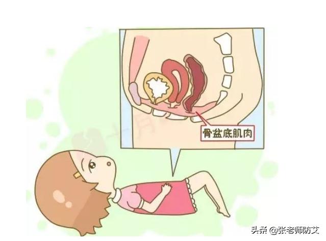 产后三年盆底肌修复的方法,产后两年如何修复盆底肌