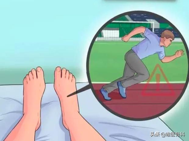 足底筋膜炎可以快走吗,足底筋膜炎快走