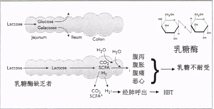 纯母乳喂养乳糖不耐受的解决方法,孩子乳糖不耐受怎么吃奶粉