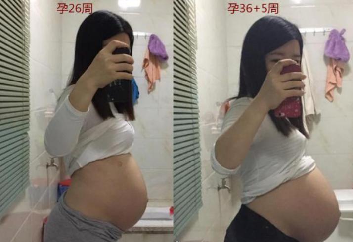 生娃以后平躺久了腰疼怎么回事,生完宝宝老是觉得腰疼怎么办