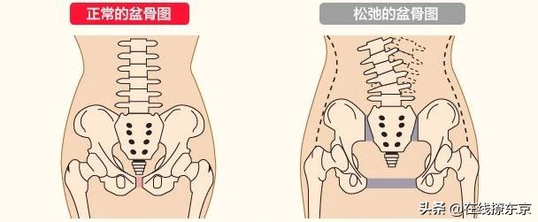 雅宝JAPAN推荐,骨盆矫正好物,产后骨盆变形的麻麻看过来