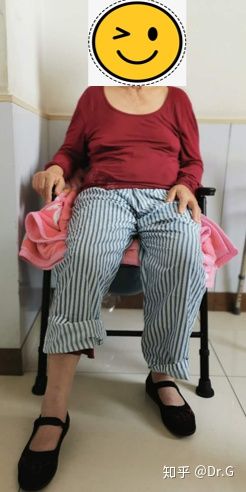 短时间用激素一定会股骨头坏死吗,没服过激素会股骨头坏死吗