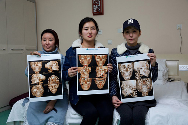 20岁的她，整成”风扇大妈“：不敢做自己，坑了多少年轻人