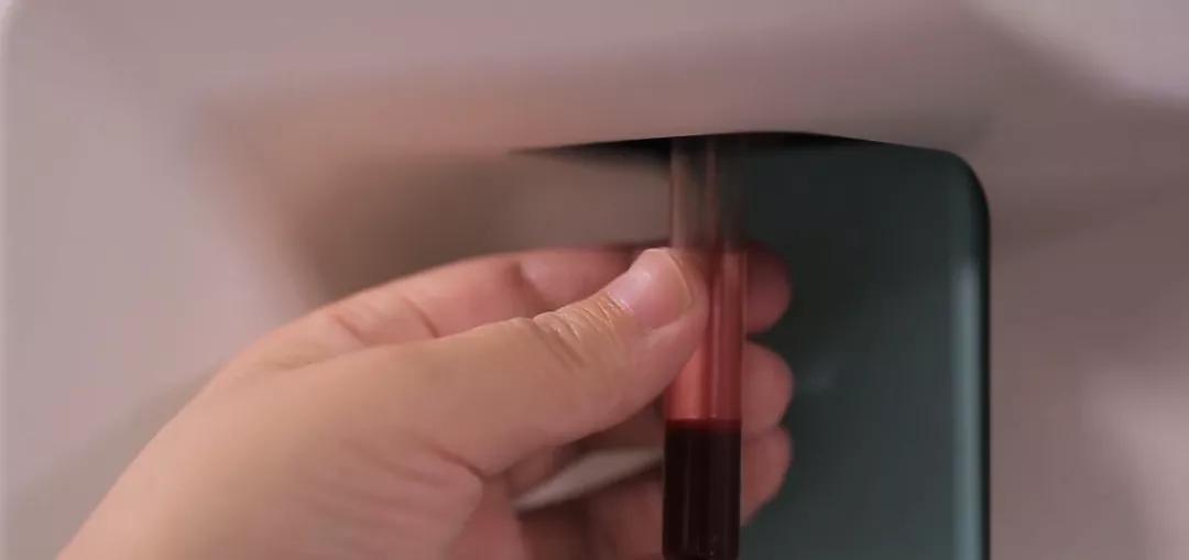 桥本轻微甲亢,桥本甲亢5年还没好