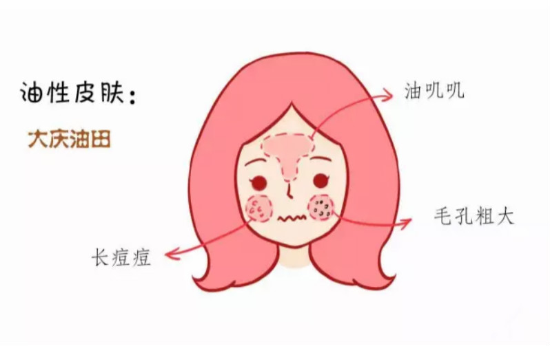 夏季油皮怎么抗氧化,夏季油皮长痘祛痘攻略