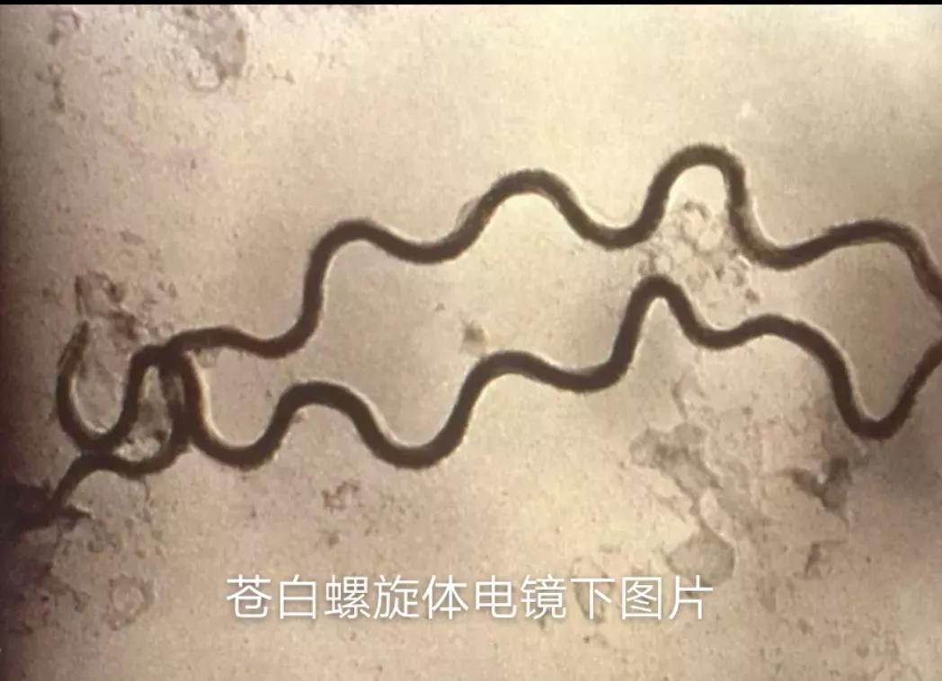 梅毒深入了解,怎样了解自己有没有梅毒