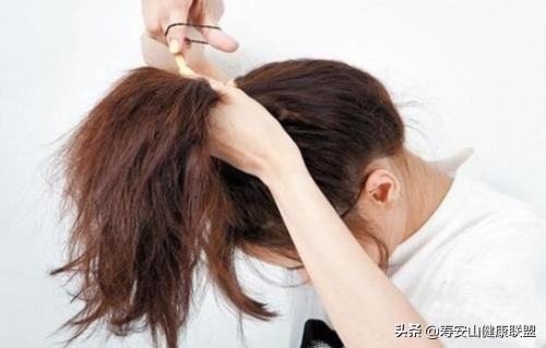 被顽固头屑缠上的四大理由，最后一个你绝对想不到