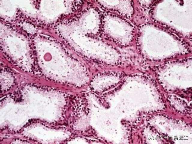 梅毒是性病吗？如何传染对人体的危害，是什么？