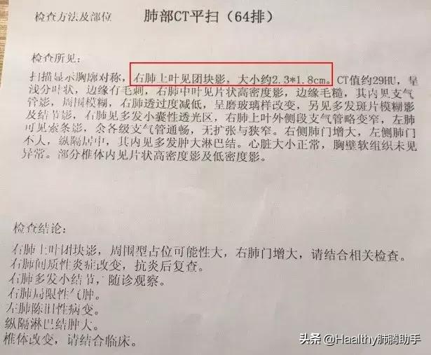 猝不及防确诊肺癌，靶向药副作用一个都没落下，什么让我坚持？