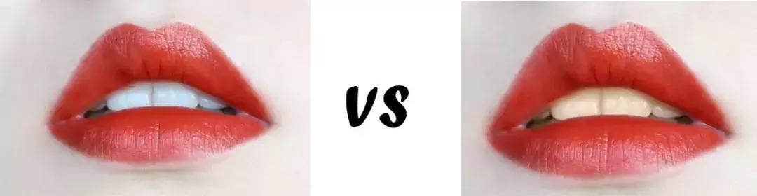 牙白一度颜值瞬间升三度,牙齿白有多重要