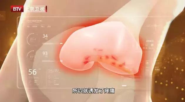 关节抽积液一次费用多少钱,关节有积液看中医还是西医