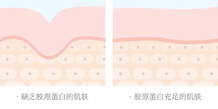 哪款美容仪才不是智商税,美容仪应不应该买