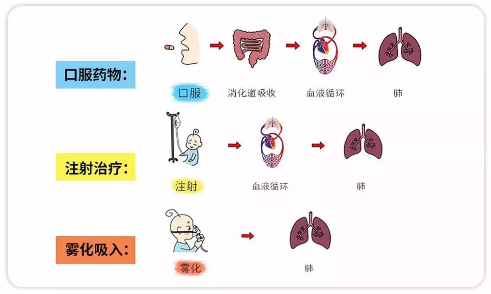 听说雾化治疗危害大?是真是假,看完你就懂