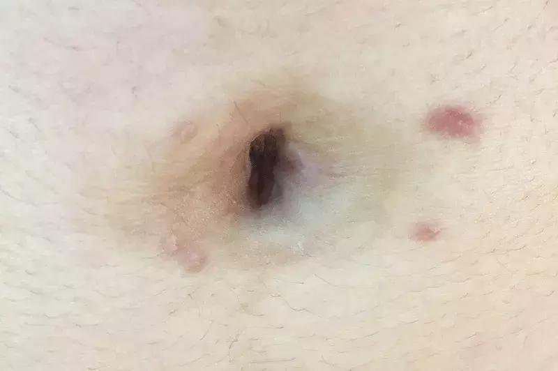 98’病人手术流水账：记录着崩溃、羞涩和坚强