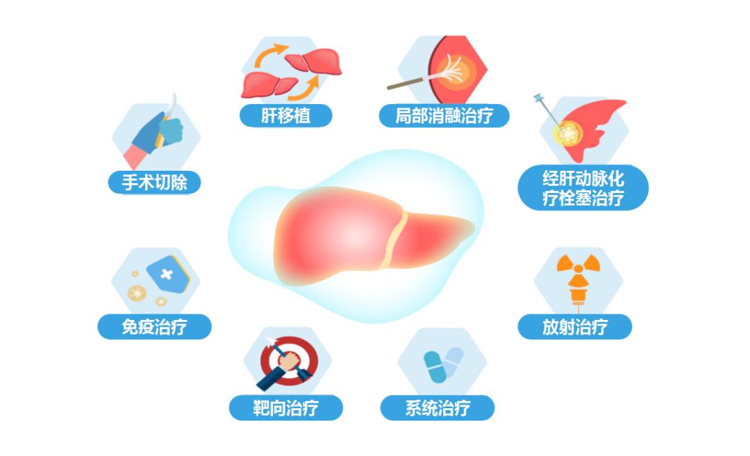 原发性肝癌mdt诊疗指南,原发性肝癌诊疗指南2022