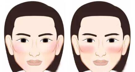 太阳穴凹陷颧弓外扩怎么画眉毛,太阳穴凹陷颧弓突出明显怎么化妆